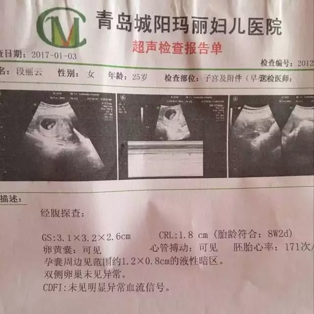 懷孕多長時間能測出來男女孩：懷孕多長時間能查出是男孩還是女孩？