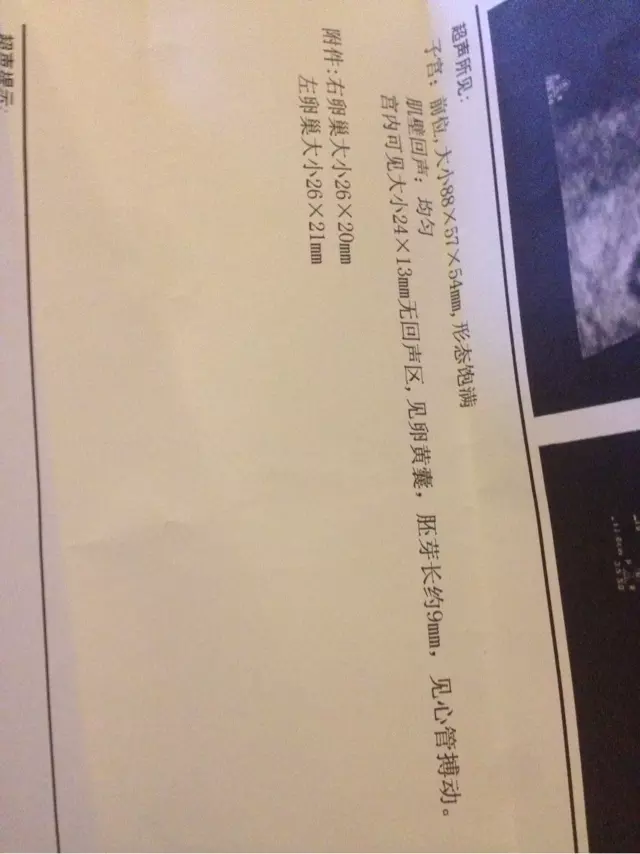 懷男孩女孩物的區別：懷男孩和懷女孩的區別有哪些