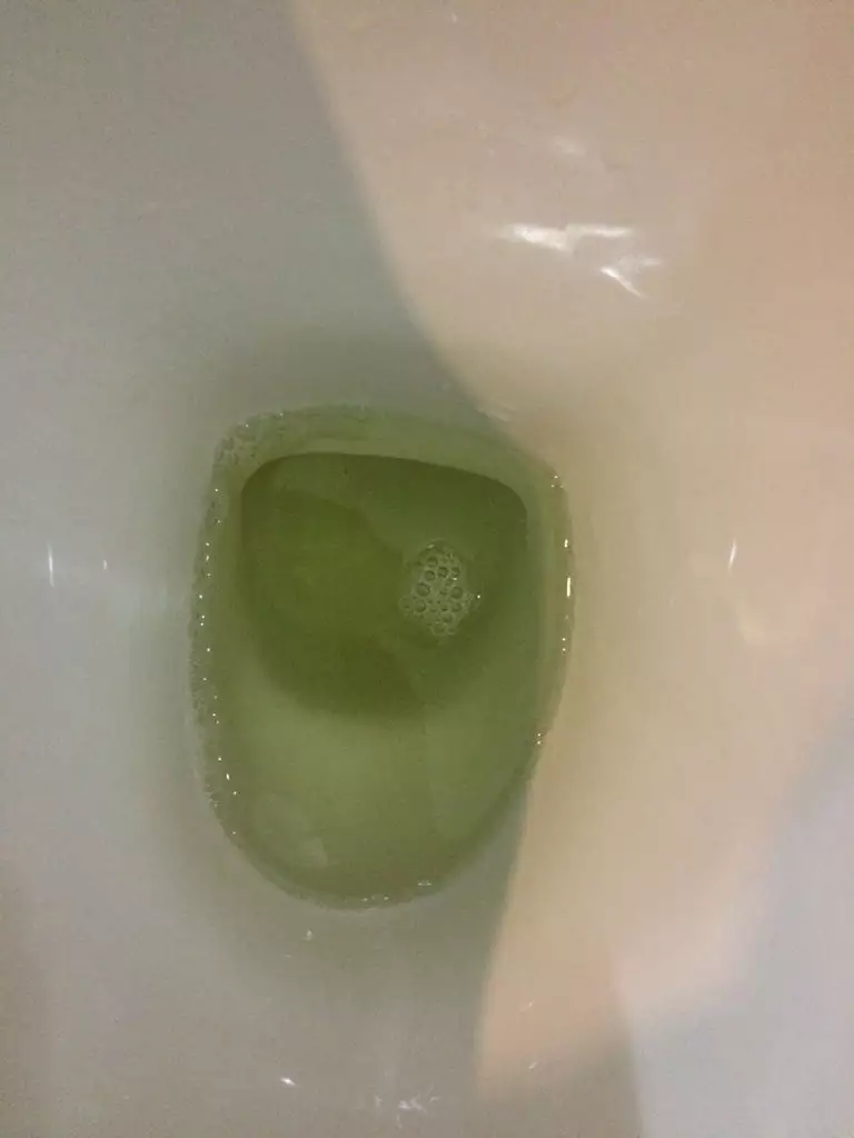 懷孕后尿的顏色有什麼變化：JMS覺得懷孕前後顏色有變化嗎？