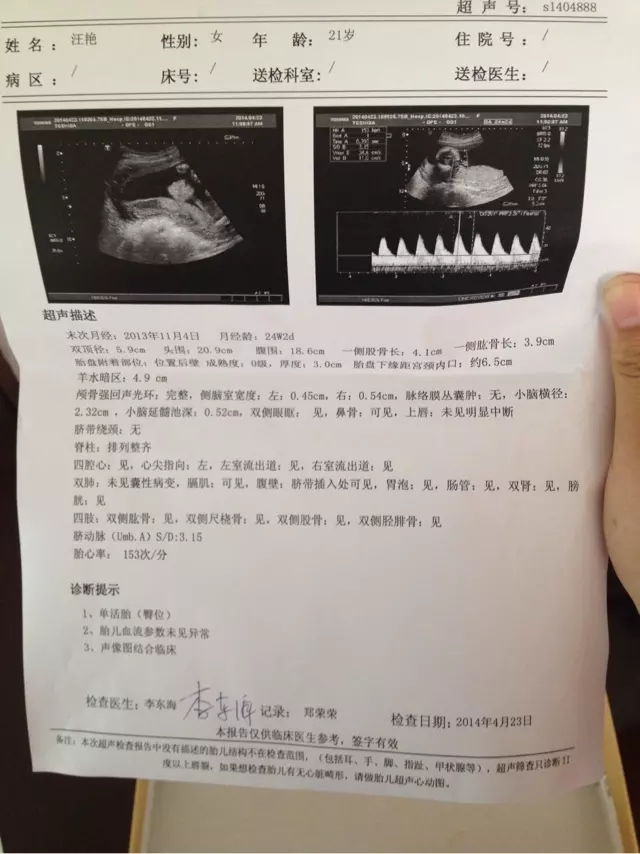 懷孕2個月怎樣辨別男女：懷孕兩個月能看出男女嗎？通過什麼方法驗出來的比較準確呢？