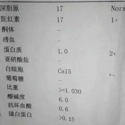 早孕的是什麼顏色：懷孕的人，尿是什麼顏色的