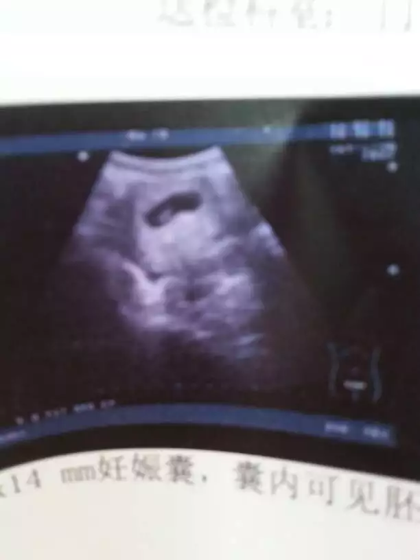 懷女兒跟懷兒子癥狀有什麼不同：懷兒子和懷女兒的時候有什麼區別
