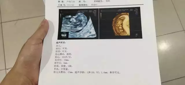 頭胎頭旋看下胎男女准嗎：頭胎女孩頂順時針轉看下胎性別