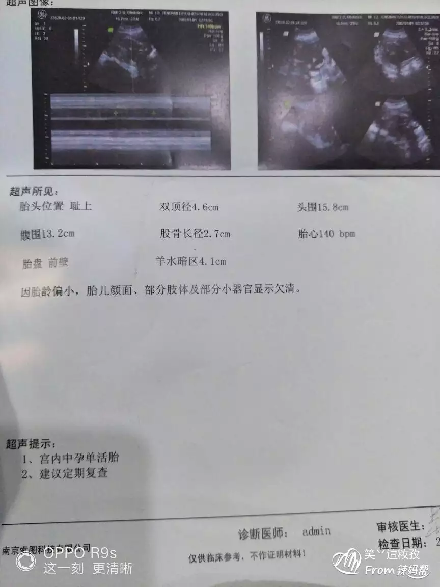 懷女兒最準的癥狀播種網：懷女兒的癥狀主要都是些什麼呢？