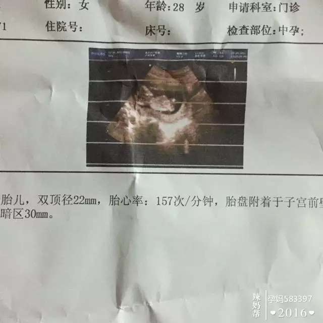 4、屏幕亮點壞點是什麼意思？亮點壞點，0的屏幕，出現了三個以上五個以下的亮點壞點。