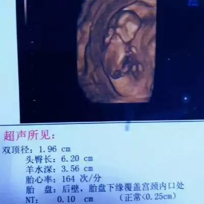 4、10秒測出懷男孩和女孩:懷男孩是不是比女孩晚測試出來