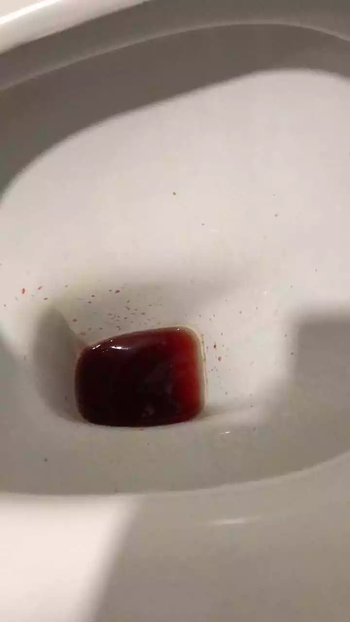 懷男孩的什麼顏色：懷男孩晨尿是什麼樣的