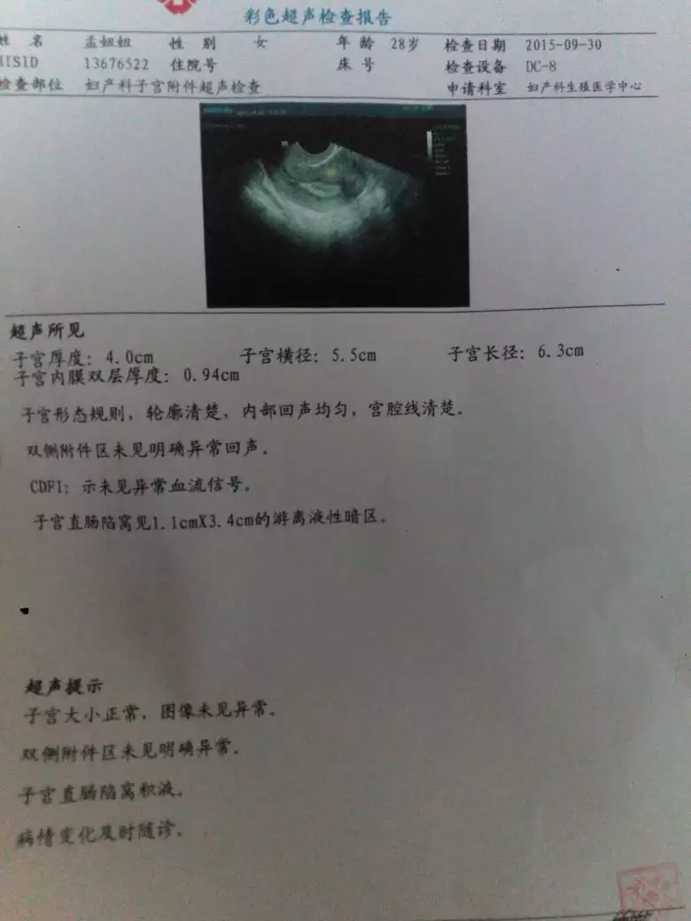 懷孕初期孕囊小的原因：孕囊小是什麼原因 婦科專家為你細說孕囊小的原因