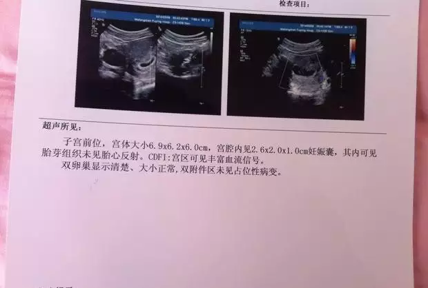 命里有幾個孩子就一定會生嗎：算命 生辰八字命中註定有幾個子女