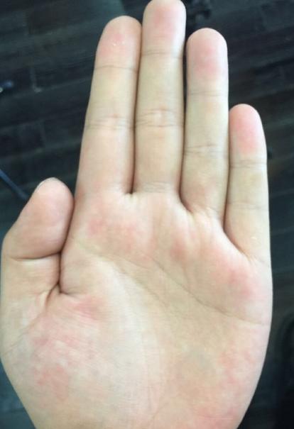1、婚姻有第三者介入的手相:手相看哪些人易有外遇