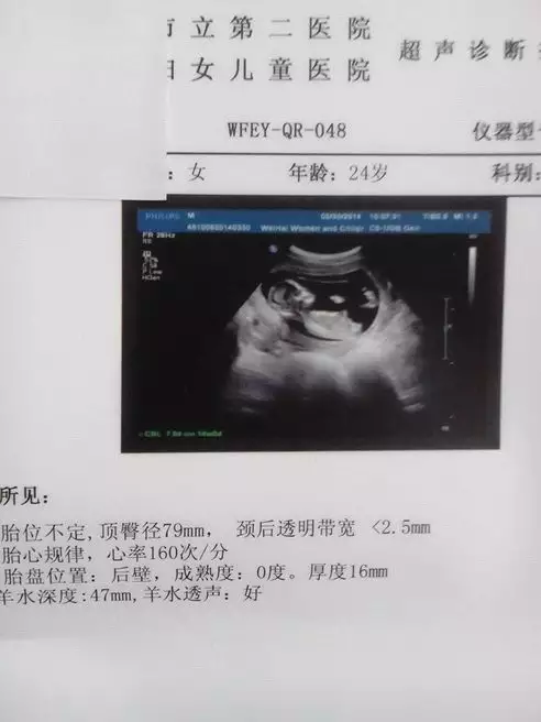 剛懷孕怎麼知道男女妙招：剛知道懷孕怎麼知道男女？