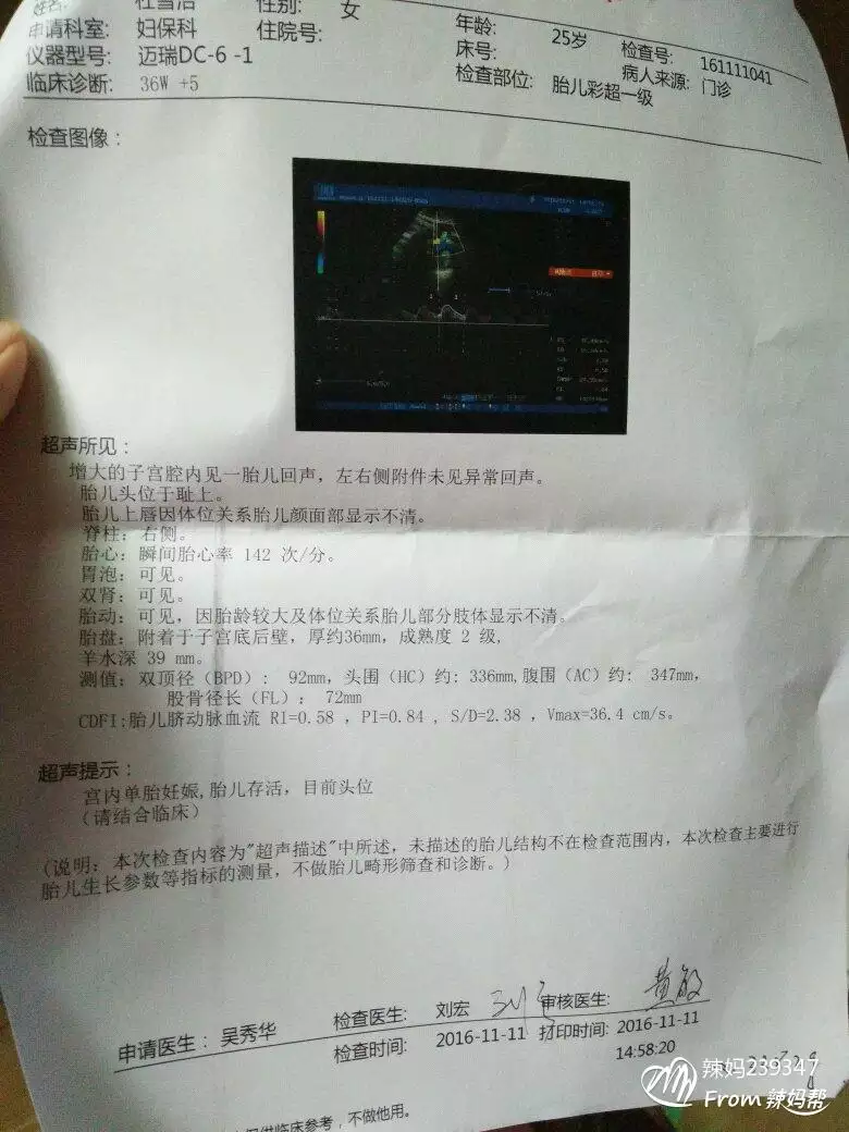 孕晚期胎心多少是男孩：寶胎心率一般是多少