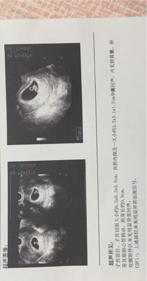6一7周孕囊大小看男女B超圖：40天孕囊是男孩還是女孩