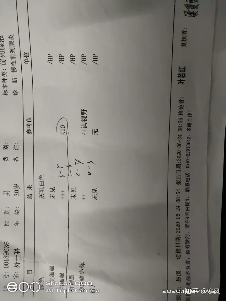 4、戒掉sy后能恢復性功能嗎:長期SY導致的和戒掉SY能恢復嗎？