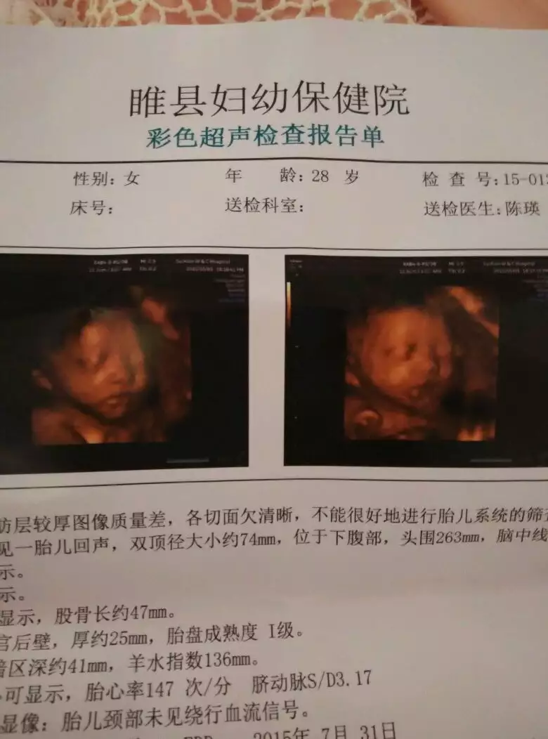 懷男孩比較早測出懷孕么：是不是越早測出懷孕就是生女兒，越晚則是生兒子啊