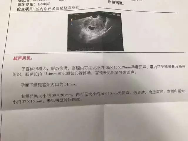 孕囊數值看男女可信嗎：聽說看孕囊形狀可以大概猜出男女性別，準不準呢，幫我看下