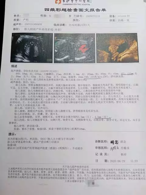 四維雙無分離是男孩女孩：雙腎無分離男孩還是女孩？