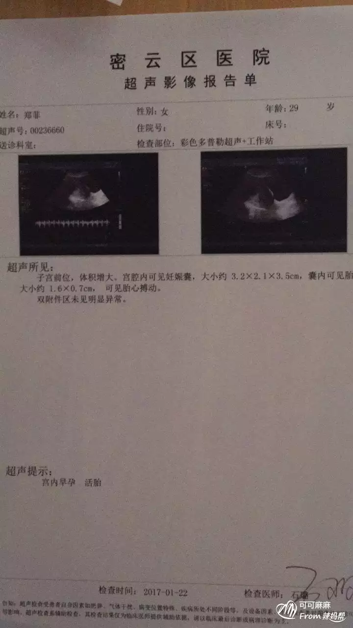 胎心在是男孩：胎心一百四十幾是男孩還是女孩