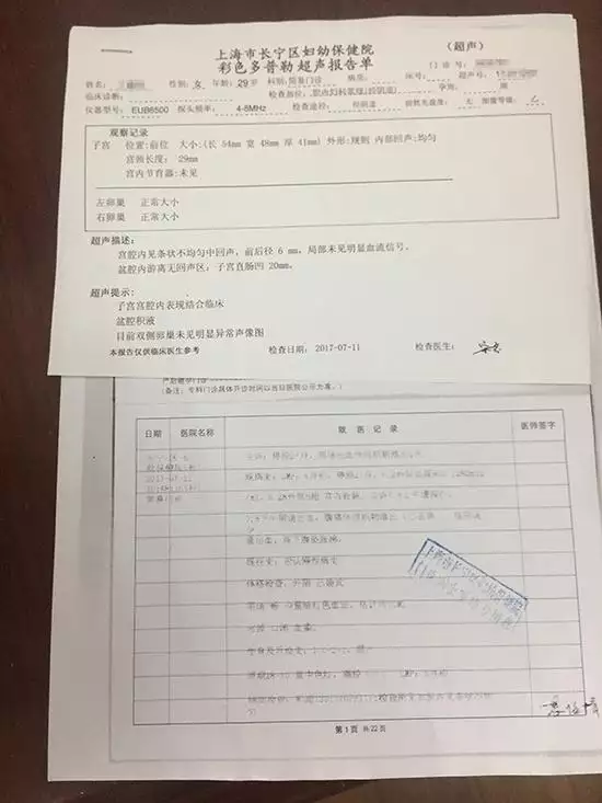 b超單是什麼樣的圖片：B超單是什麼樣的