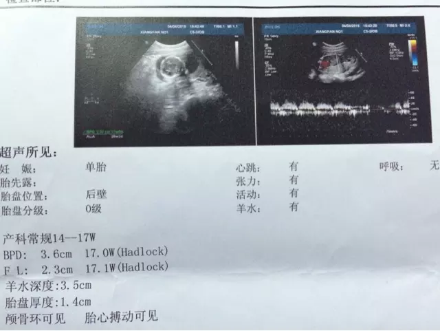 怎麼推算懷孕是男是女：怎麼看單月雙月生男生女生