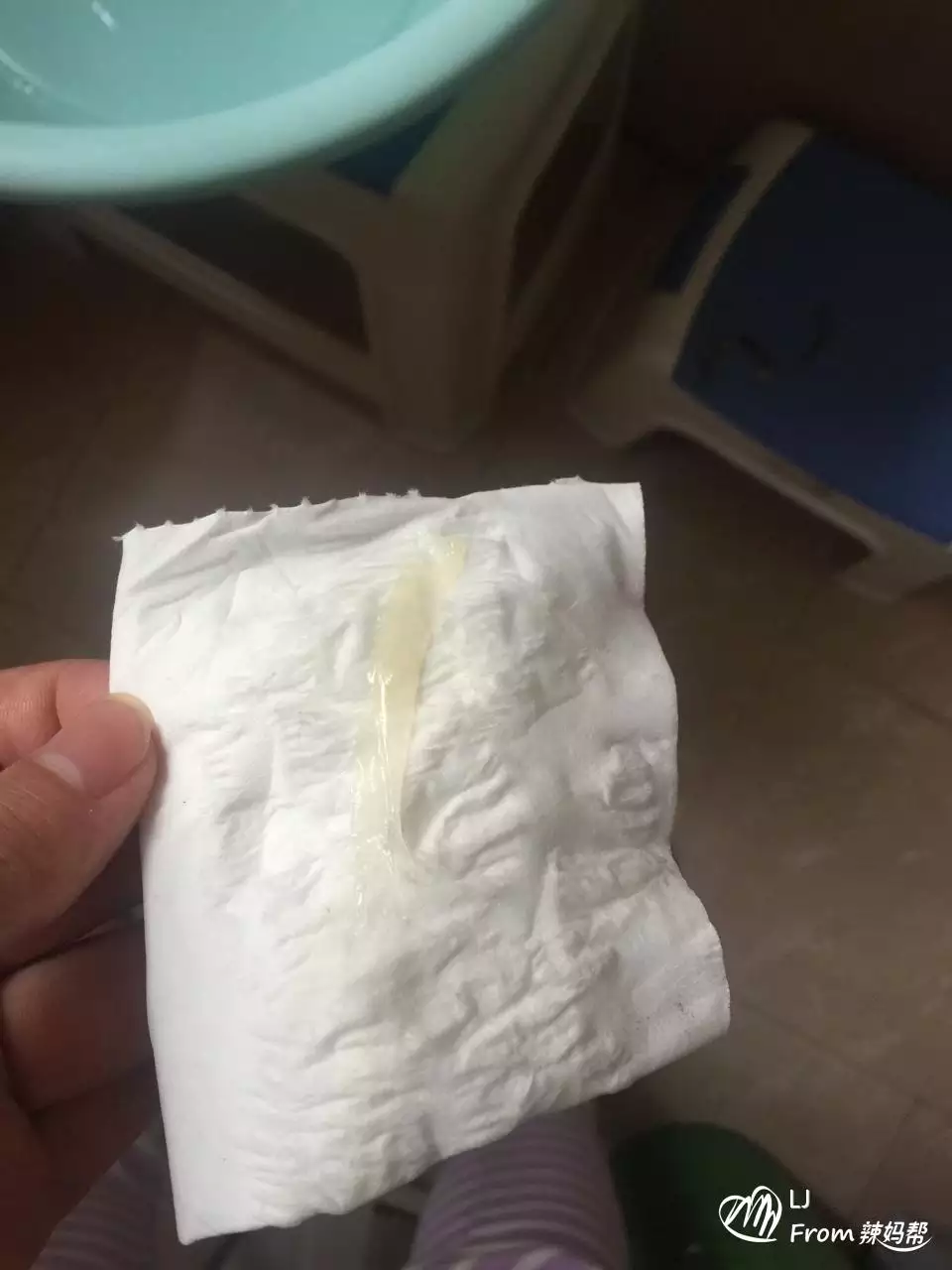 懷孕早期會變黃嗎：實際時間怎麼算