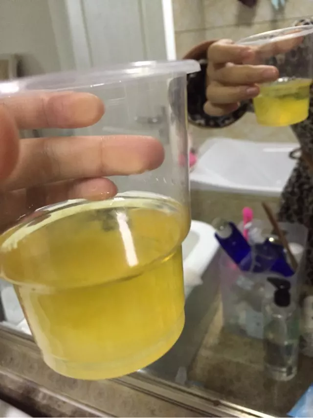 懷孕尿里加鹽測男女圖片：酒精和尿測性別圖片
