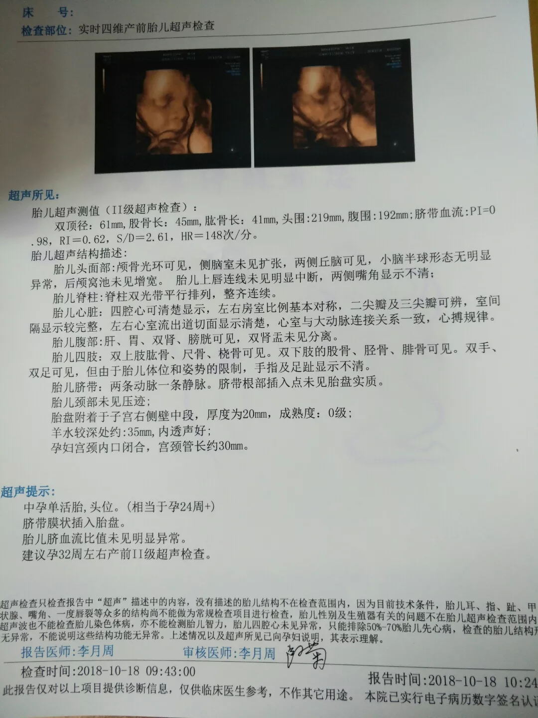 四維雙無分離是男孩女孩：雙未見分離是男孩嗎
