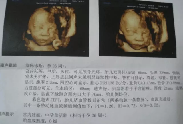 懷女兒的早孕反應是什麼：寶媽們在懷女兒和懷兒子初期，感覺有什麼不一樣嗎？