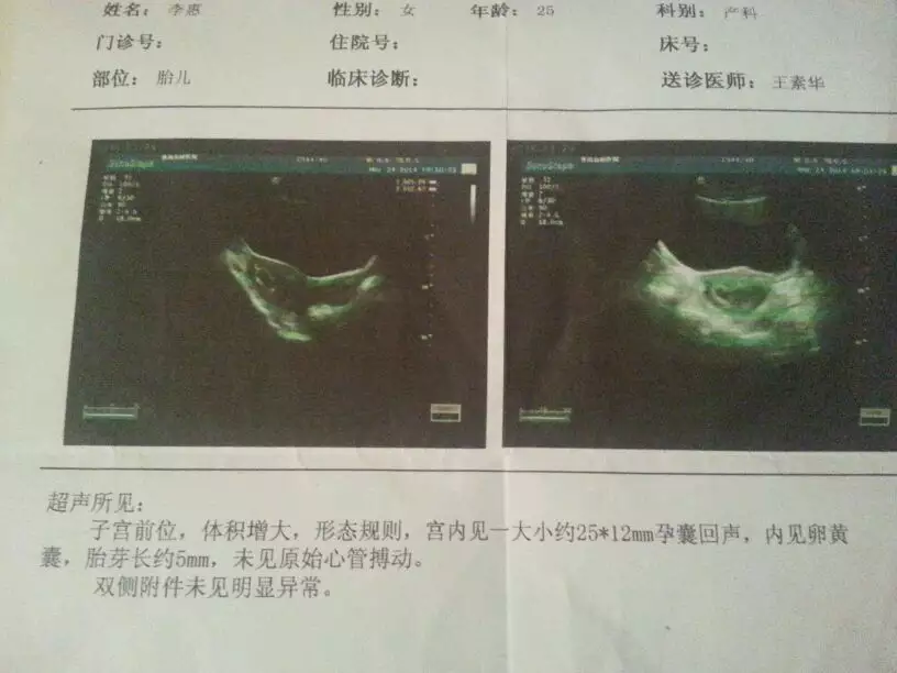 懷孕6周可以看出男女嗎：懷孕6周，想知道現在看很多微信說測卡，驗血知道男女寶寶，