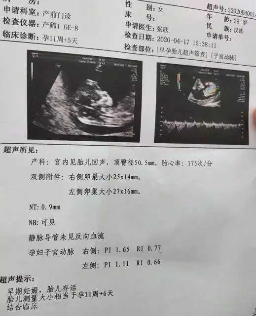 nt0.14是男孩女孩：NT能看出男孩還是女孩嗎？