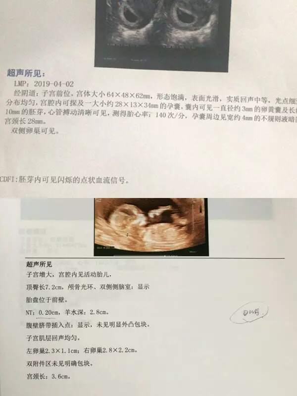為什麼女孩孕囊是圓的：看看我這孕囊是長形的還是圓形的