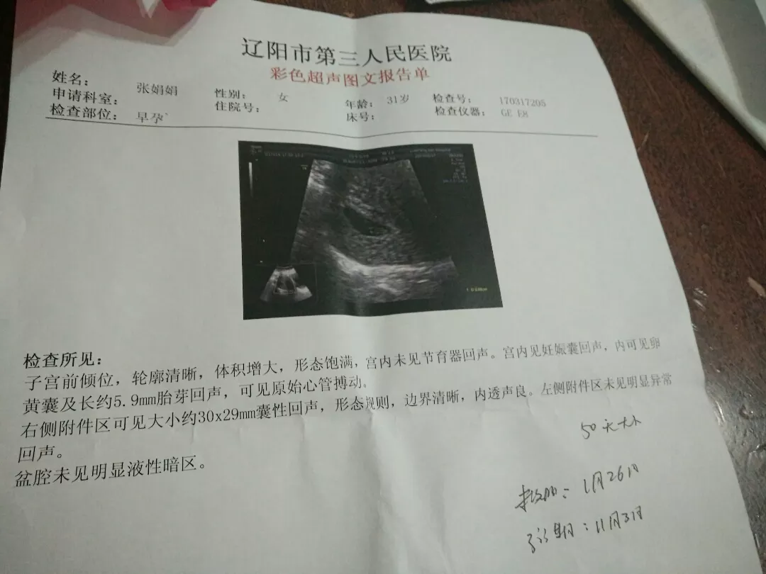 懷孕后怎麼看男女準確些：懷孕了怎樣看男女才准？