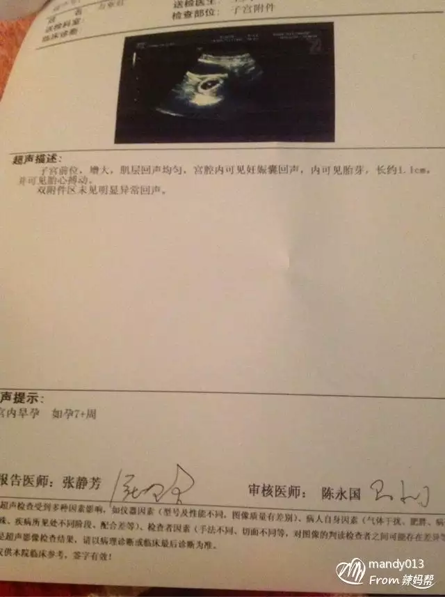 1、1一3月懷男孩癥狀:一般生男孩的懷孕有什麼徵兆?