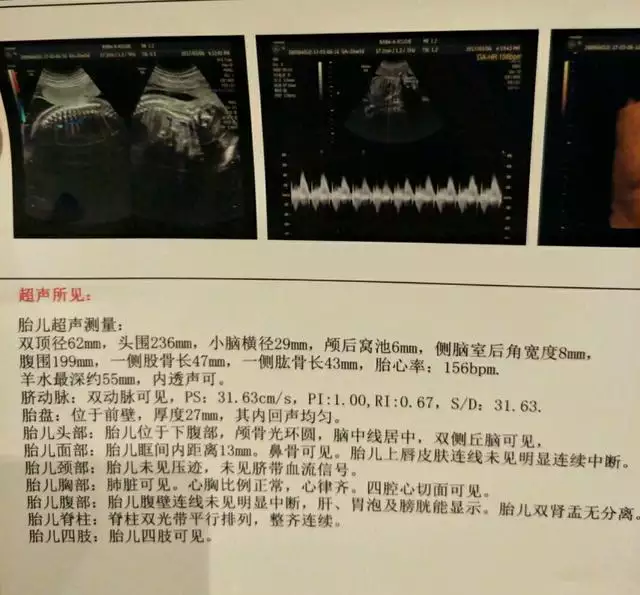 1、最科學的懷男孩方法:怎麼懷男孩？到底有沒有生男孩的方法，是科學點的