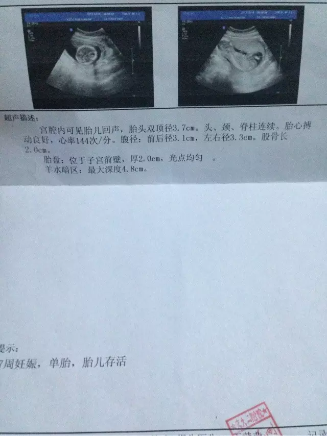 2、懷孕查男女查最准方法:有什麼最準確的方以辨別男女