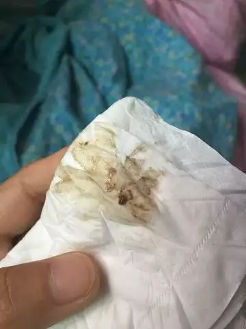 懷孕男孩尿是什麼顏色：懷孕后的是什麼顏色