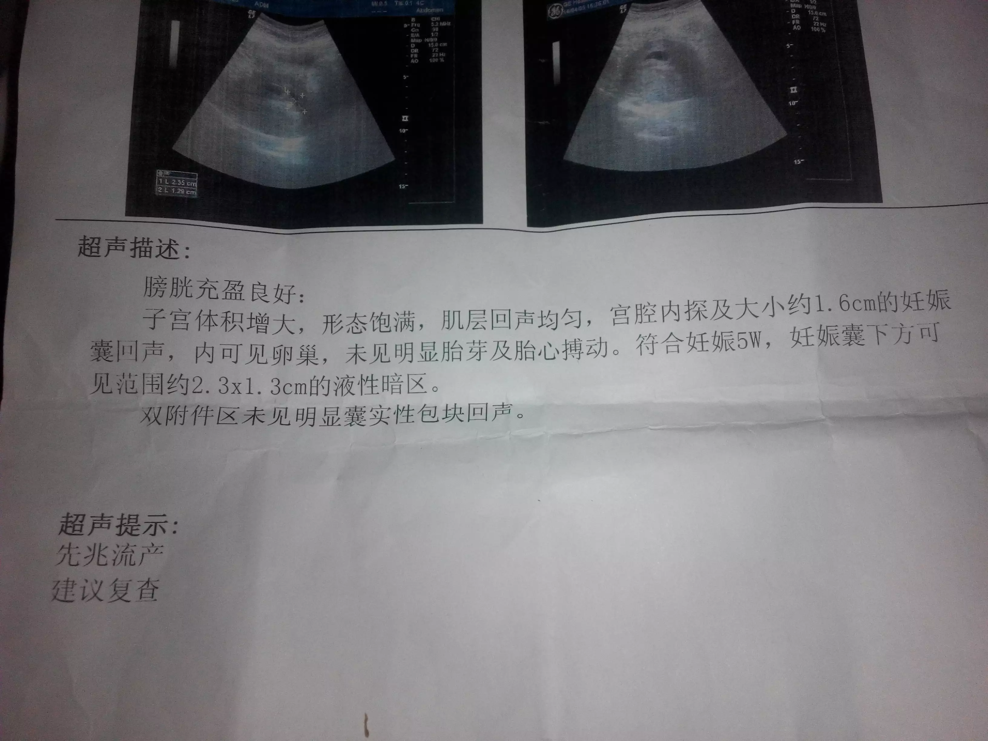 懷孕10天最明顯的徵兆：拉懷孕10天最明顯的徵兆