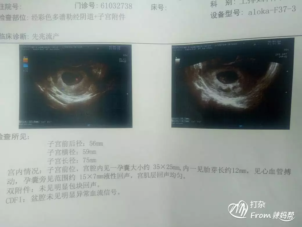 除了b超還有什麼辦法測男女：除了b超還有什麼辦以測男女嗎