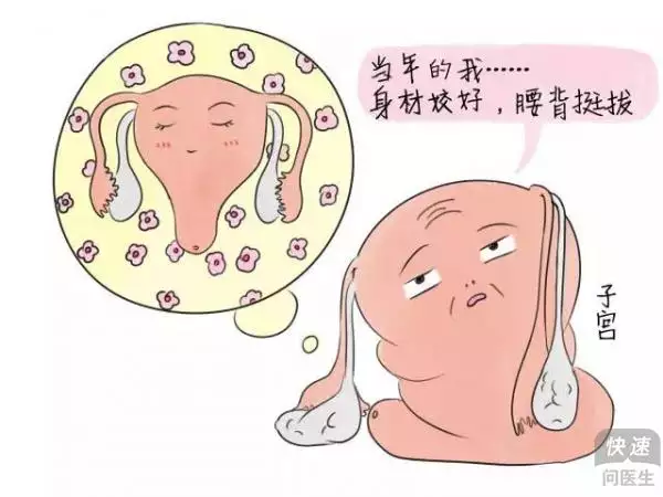 5、後下癢是誰的責任:后女人一直痒痒是怎麼回事?