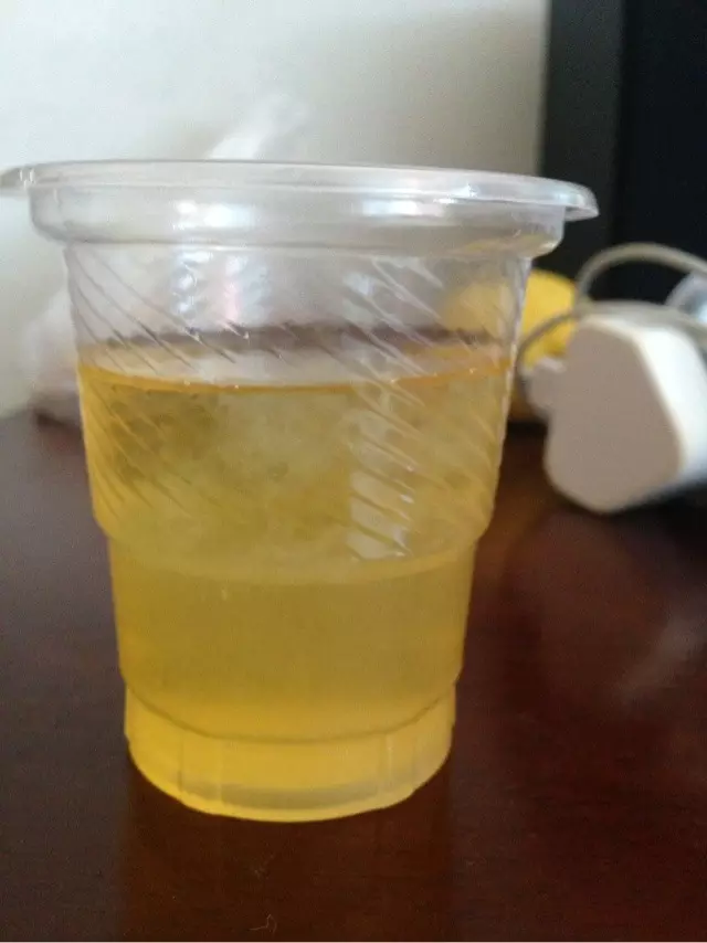 用酒精測試懷男女的方法：大家看一看，酒精測試男女，看圖片是男還是女