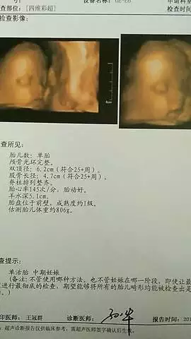 用什麼方法測男女最准：有什麼最準確的方以辨別男女