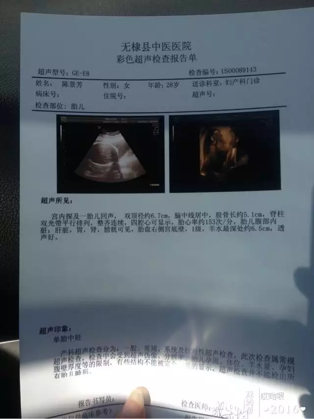 懷孕六個月看男女秘方：懷孕時看男女最準的方法