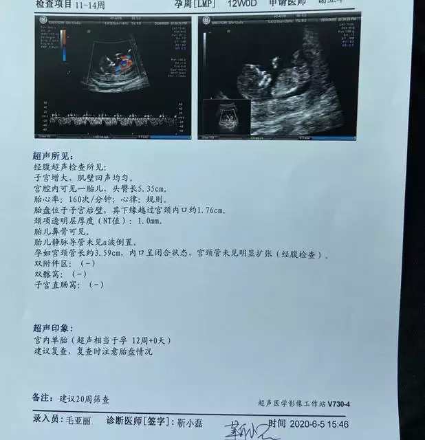 nt值看男孩女孩訣竅：怎麼通過nt看男女性別