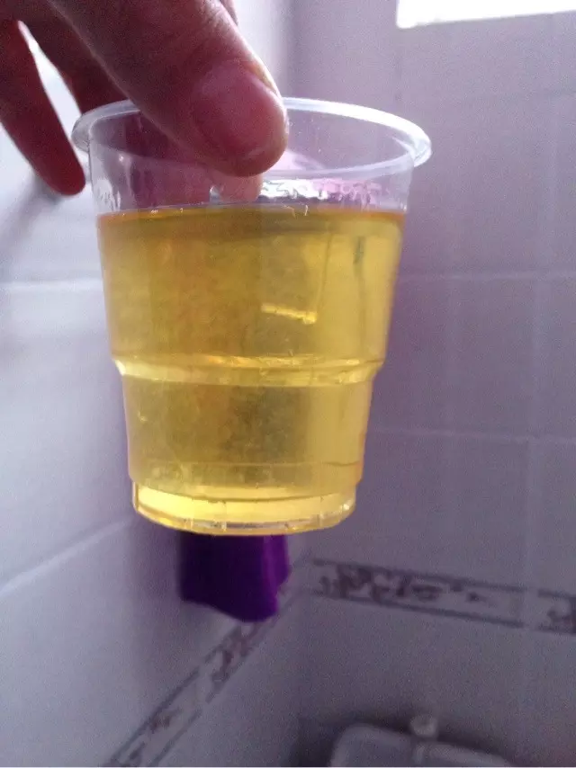 用酒精檢測男孩女孩確定嗎：酒精測男女准嗎？
