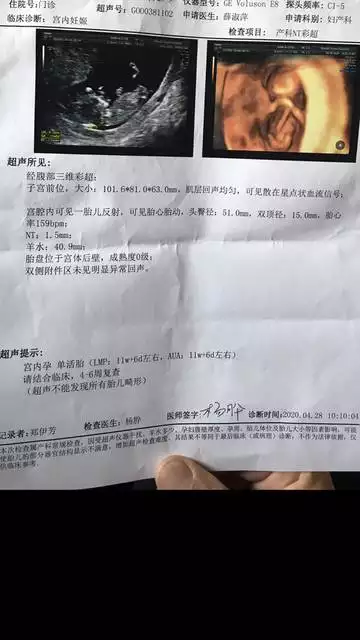 b超看男女幾個月最准：B超最早幾個月能看出男孩女孩？準確率有多高？