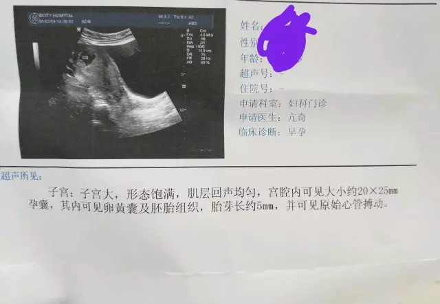 懷孕50天懷男孩表現：孕囊什麼時候看形狀最准