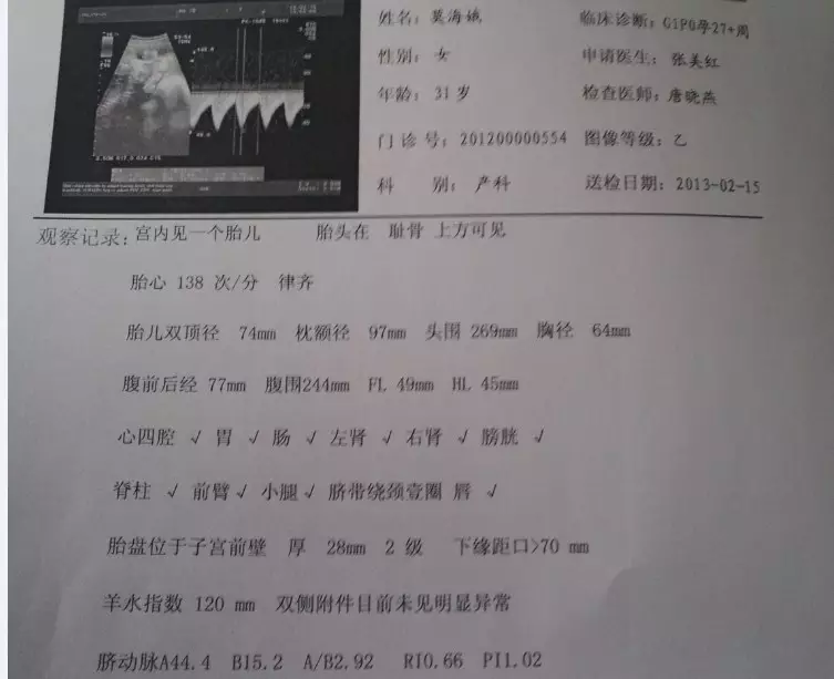 怎麼測試自己懷的是男孩女孩：怎麼才能知道自己懷的是男孩還是女孩