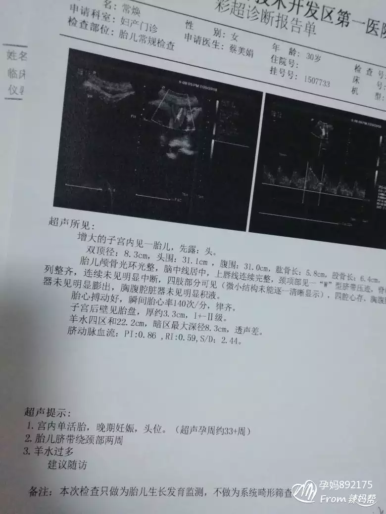 懷孕2個月怎麼看男女准嗎：兩個月怎麼判斷男女