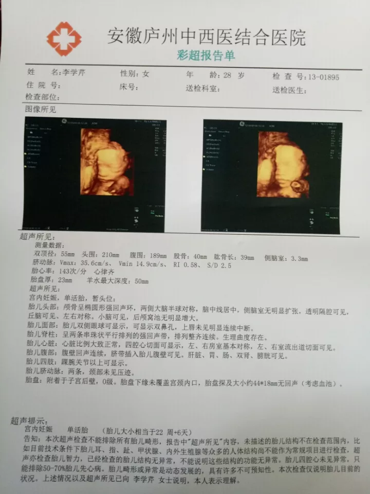 四維彩超右上角ml什麼意思：做四維的時候寶寶不動怎麼辦