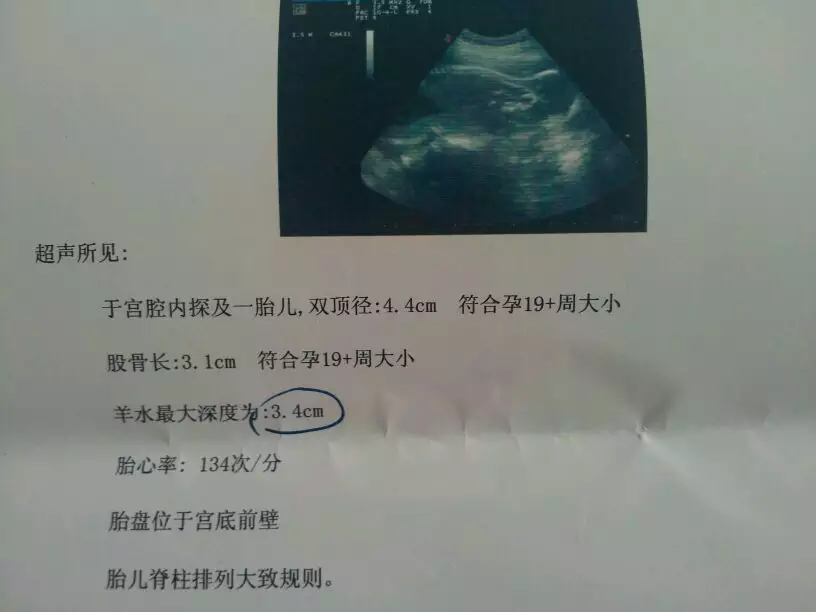 孕初期可以看出男女嗎：有什麼最準確的方以辨別男女